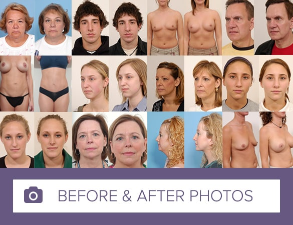 1756248547_before-after-1