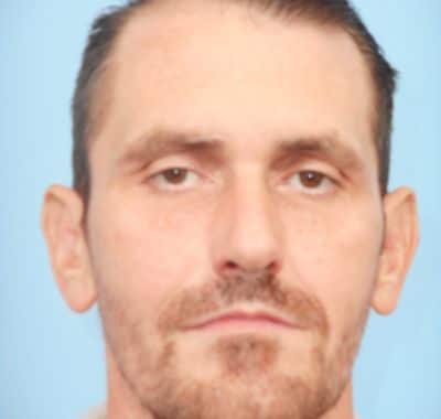 After Image: Ear Pinning - front