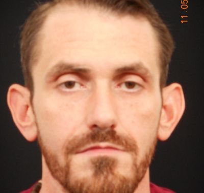 Before Image: Ear Pinning - front