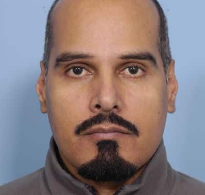 After Image: Eyelift - front