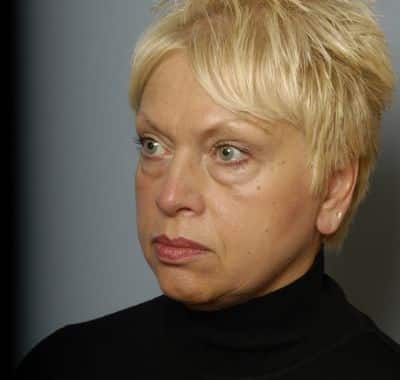 Before Image: Eyelift - left-front-oblique