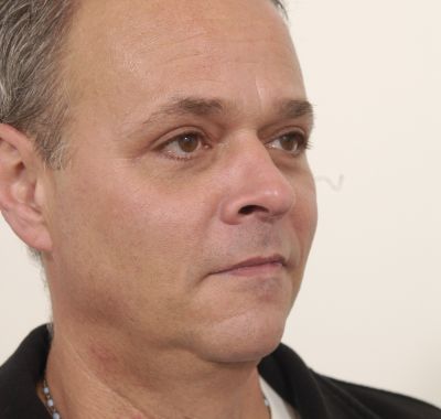 After Image: Eyelift - right-front-oblique