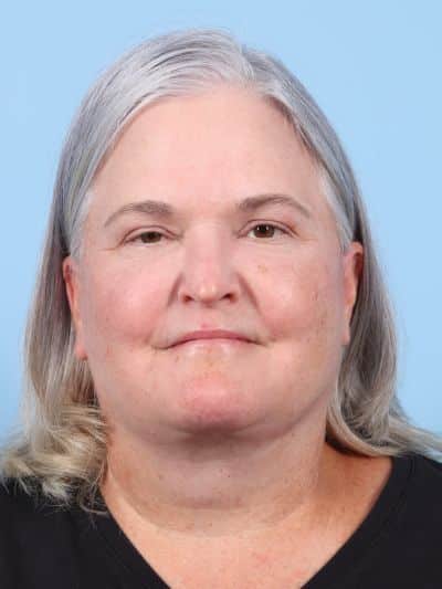 After Image: Facelifts/Necklifts - front