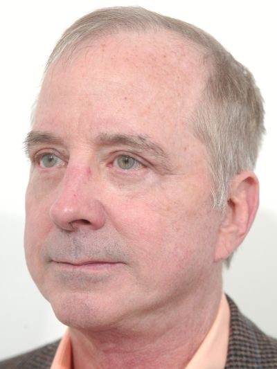 After Image: Facelifts/Necklifts - left-front-oblique