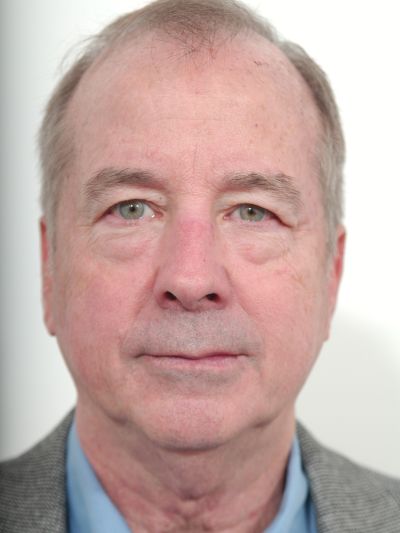 Before Image: Facelifts/Necklifts - front